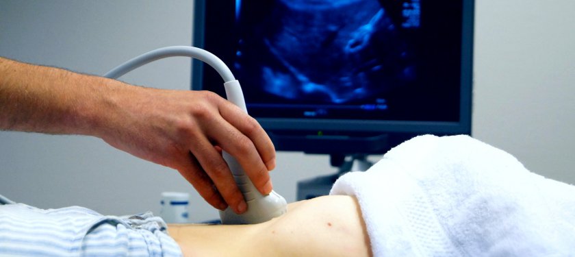 4D Ultrason Hakkında Merak Edilenler