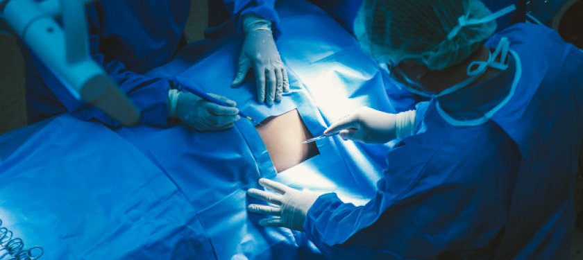 Kapalı Rahim Ameliyatı (Laparoskopik Histerektomi)