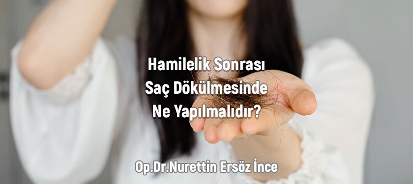 Hamilelik Sonrası Saç Dökülmesinde Ne Yapılmalıdır?