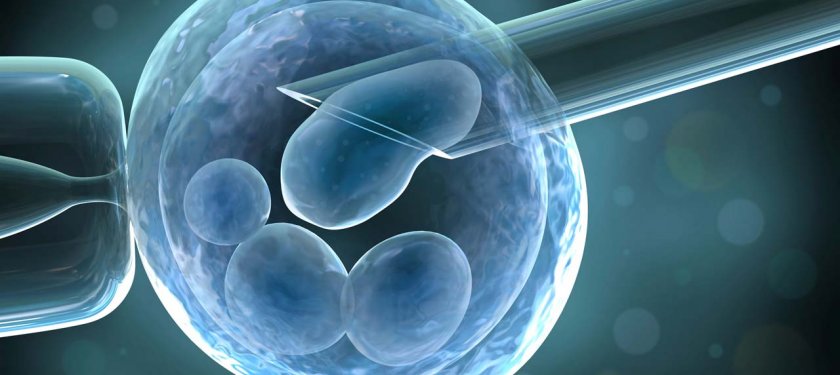 Tüp bebek tedavisi ve aşamaları nelerdir?